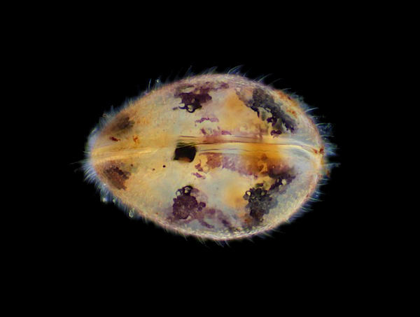 Cypridopsis vidua The freshwater ostracod Cypridopsis vidua. Click on the image for next one in the series.