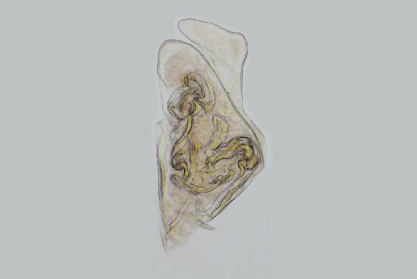 The male sexual organ of <i>Heterocypris rotundata</i>. Ostracods have two sets of sexual organs, one each side of the body, which are used simultaneously during copulation. The shape of the male sexual organ is useful for identifying species. 