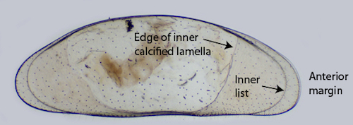 The ostracod carapace