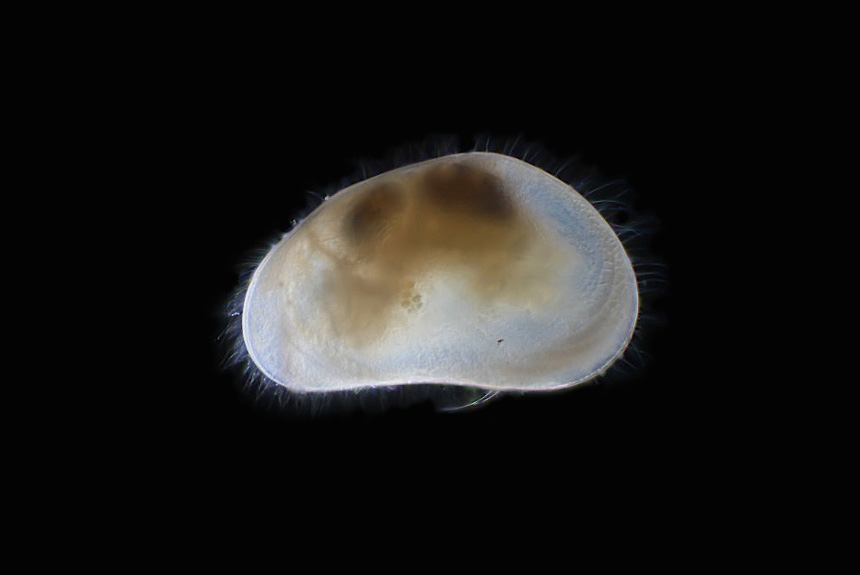 <i>Pseudocandona atmeta</i>, male, left side view, length 1.2 mm. This species was discovered living in a bog in the northern part of Honshu, Japan. There are still many species of freshwater ostracods yet to be discovered and described, including in Japan.  